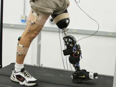 A participant with a powered knee-ankle prosthesis and motion-capture markers walks on a treadmill.
