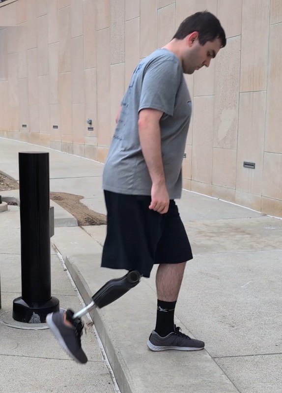 An above-knee amputee participant steps up onto a curb outdoors using the Össur Power Knee.